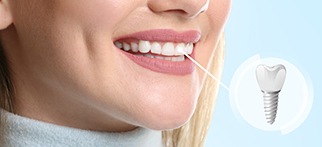 a close-up of a patient’s dental implant