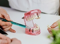 a dentist demonstrating how dental implants work