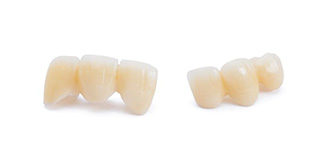 Two dental bridges displayed against white background